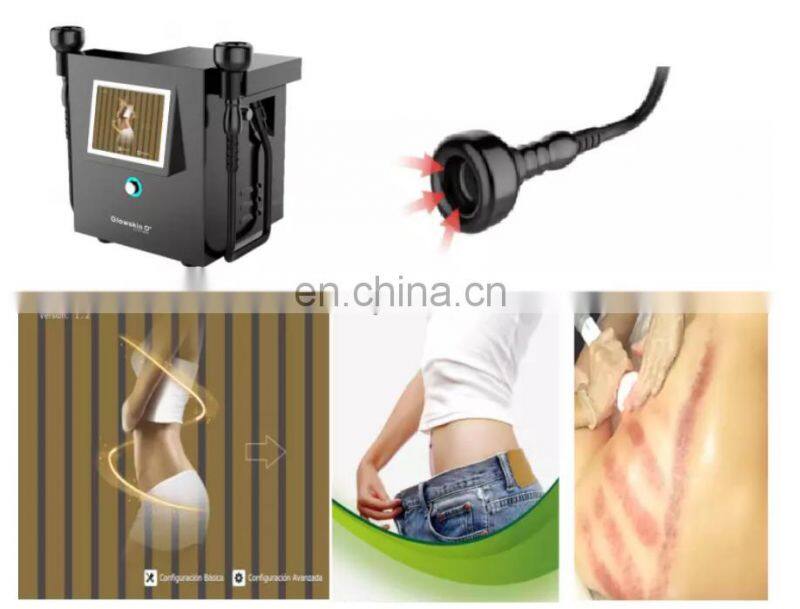 Sales Body Slimming Machine / Rf Vacuum Dotex Body Shaper Equipment / Salon Use Cavitation