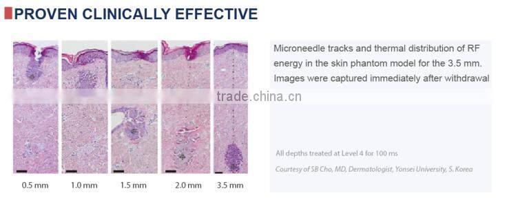 Hot selling PROMOTION Microneedle skin rejuvenation beauty machine rf generator
