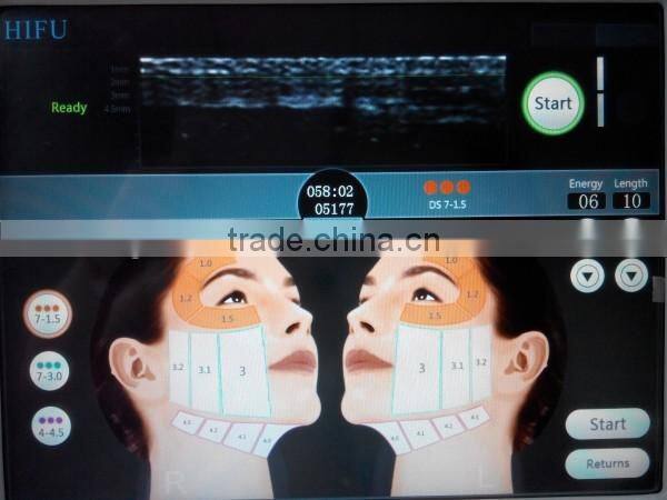 HIFU Facial Beauty Machine for Face lift Brow Lift