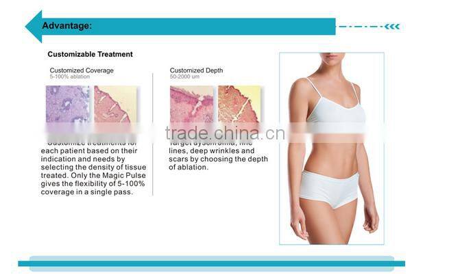 New Year promotion CO2 fractional laser vaginal tightening scar removal machine with CE--CV-II