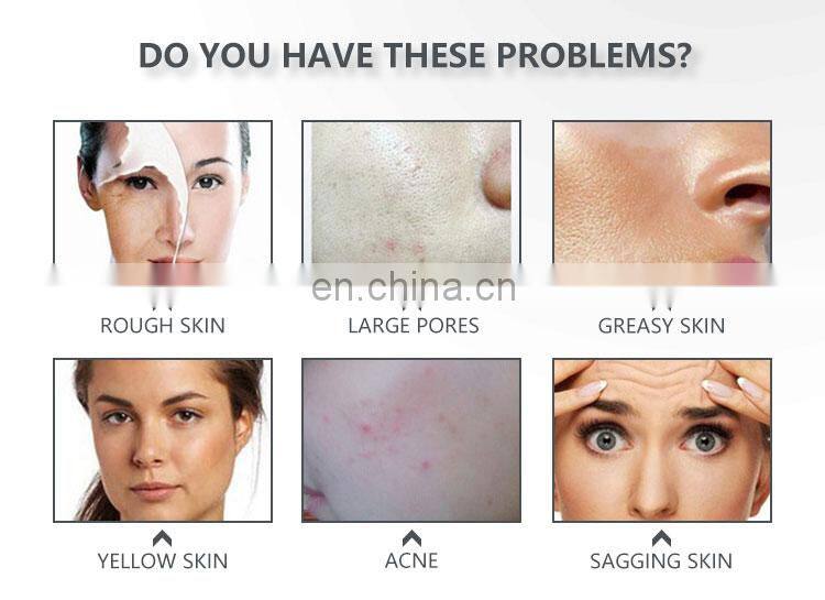 Renlang Microcrystal Technology RF Insulation Microneedle Acne Removal Cold Hammer Skin Care