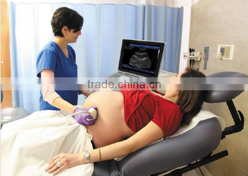 Hot Sale Full Digital Technology Ultrasound Scanner/ Echographe With Ce And Iso