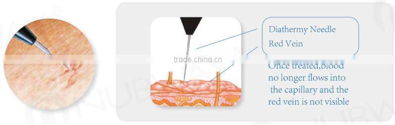 2016 30M HZ High Frequency RBS100 Spider Vein Removal machine / Vascular Removal Machine