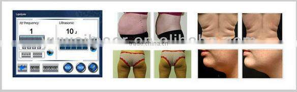 cellulite reduction machine