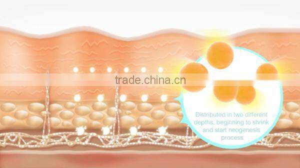 Guangzhou HETA Cryo + RF Ultrasonic Cavitation fat freeze slimming machine