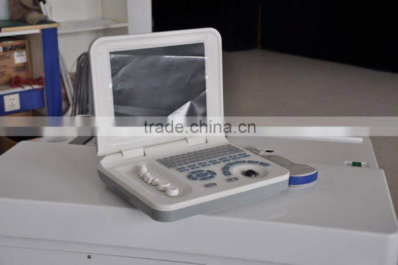 Wholesales Medical Supplier Portable laptop Ultrasound Machine for Pregnancy