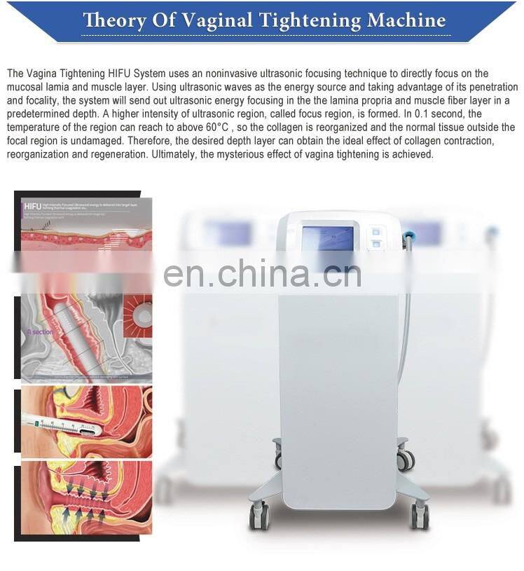 Vaginal HIFU Machine Anti-wrinkle Vaginal Tightening Machine for Beauty Spa