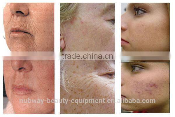 Multifunctional 3 handles radiancy global ipl korea