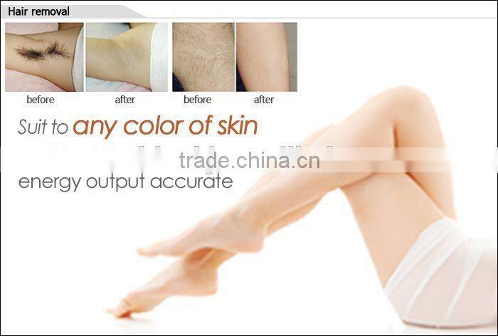 Durable portable IPL SHR OPT for permanent hair removal beauty machine