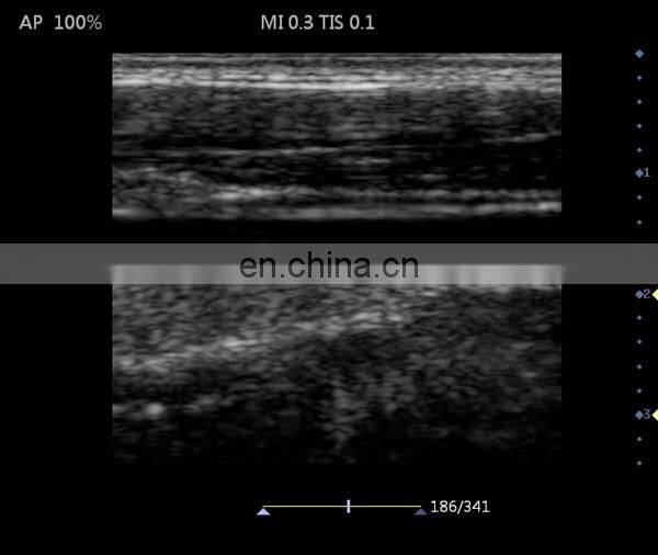 HC-A006B Full digital 15 inch Laptop Ultrasound machine with competitive price(ARM based)