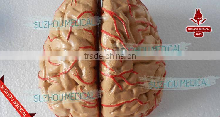 Distribution of brain and cerebral arteries