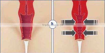 40W fractional co2 laser Surgical machine for Scar removal and Wrinkle