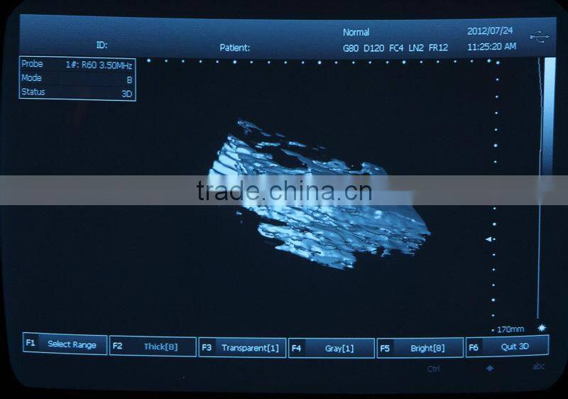 CE Mark Medical Equipment Portable ultrasonic/Cheapest ultrasounic Scanner/Machine 3.5Mhz multi-frequency Convex Probe-Shelly