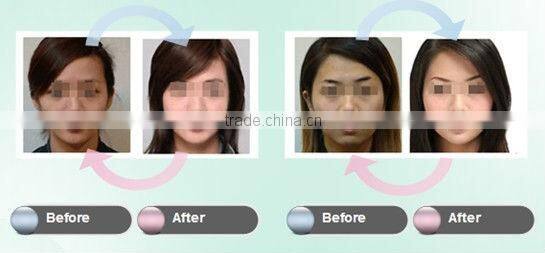 hand held rf facial with light gel mask skin tightening beauty machine