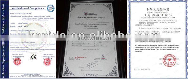 Konida dental hot sex 14*17 agfa medical filmagfa holder fuji dry film