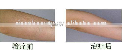 Multifunctional beauty salon machine E-light/ IPL/ RF functions for beauty salon use