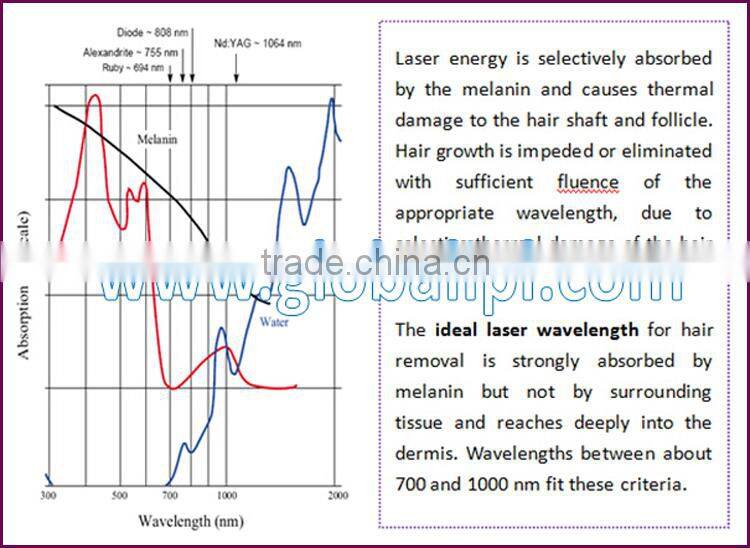 best things to sell laser hair removal process made in China