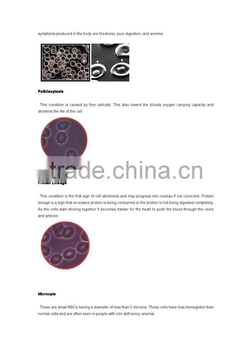Live Blood Test machine/Live Blood Screening machine
