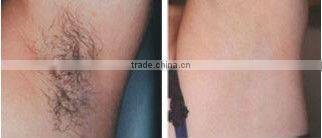 2013 New design ipl hair removal Machine Guangzhou