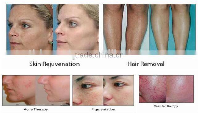 Micro-printer Available aesthetic devices