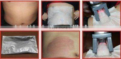 Anti freezing membrane for fat freezing machine