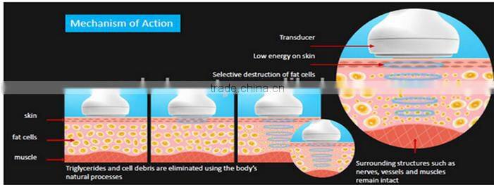 2016 portable HIFU shaping and face lifting machine/ limming beauty machine RF + vacuum slimming weight loss