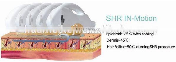 Super hair removal/ ipl shr hair removal machine with big spot