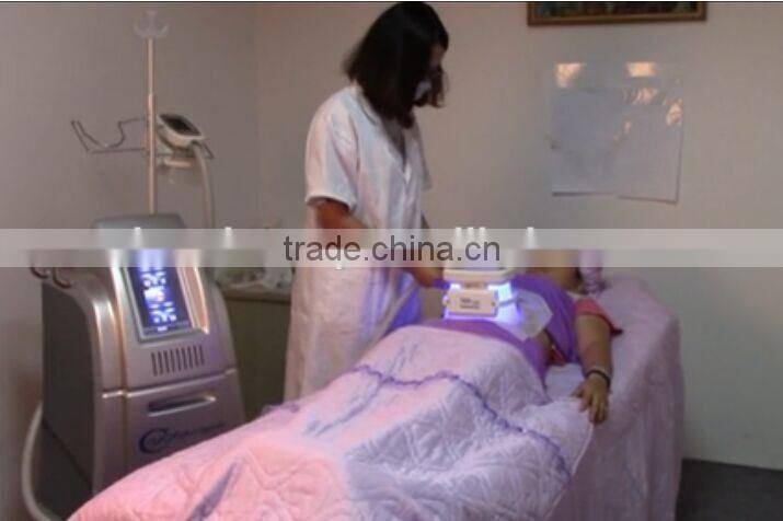 Best price of cryotherapy fat freeze machine for fast and effective cellulite removal