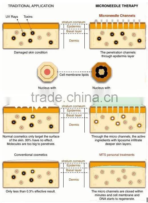 Derma skin tender dermaroller wrinkles removal system DNS80A