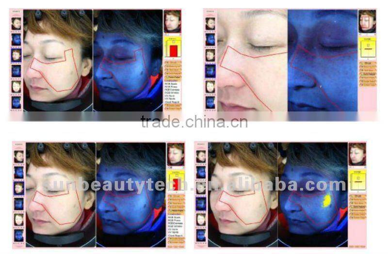 Mirror System/Skin Analyser Machine