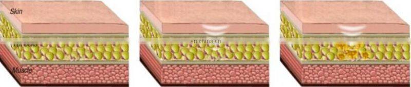 Best slimming products/ultrasonic cavitation rf slimming device