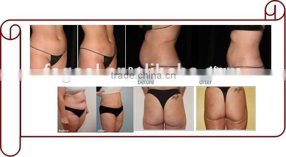 Free Shipping Home Use Cavitation Slimming Machine,ultrasound therapy tripolar RF cavitation ultrasonic machine,rf cavitation