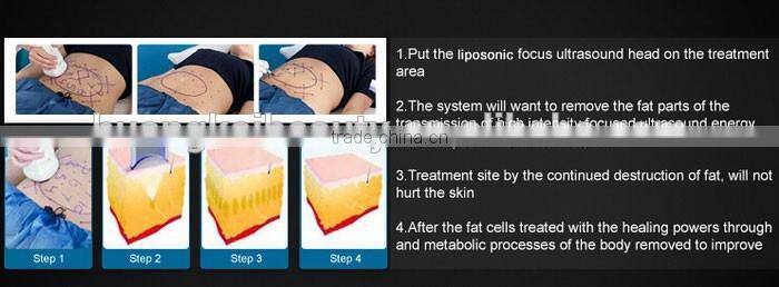 China supplier high intensity focused ultrasound slimming machine / liposunix slimming machine / fast slimming machine