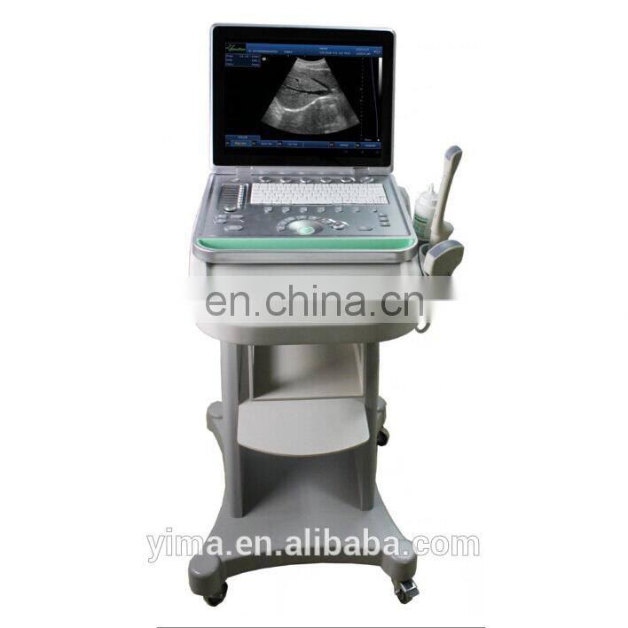 Medical diagnostic system cheaper Portable BW 3D 4D Live ultrasound Scanner Machine