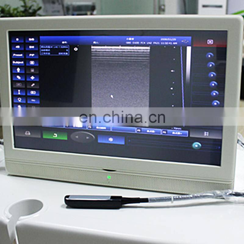 HC-A005 Pregnancy Ultrasound Scan/Medical Diagnostic Equipment/18 inch large LCD