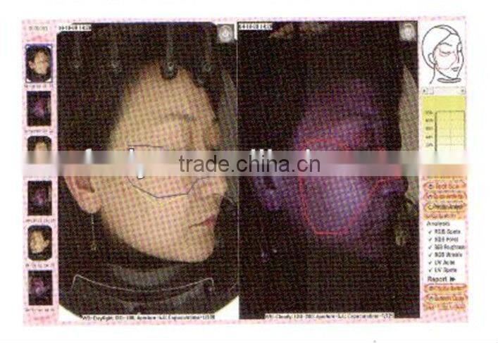 Skin Scanner Analyzer Magnifier Test Machine