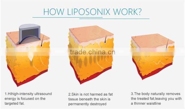 popular HIFU body slimming machine/ hifu liposonix slimming machine