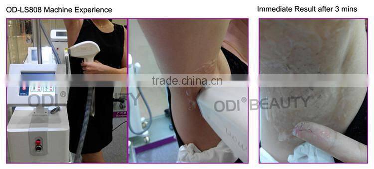 2015 Most popular 808nm diode laser / laser diode machine / laser hair removal machines