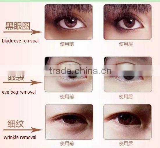 Portable rf Eye Massage V-shape face machine for removing wrinkle