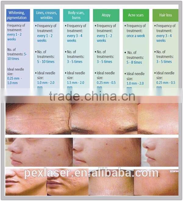 2016 derma rolling system micro needles skin care roller with 1200 needles