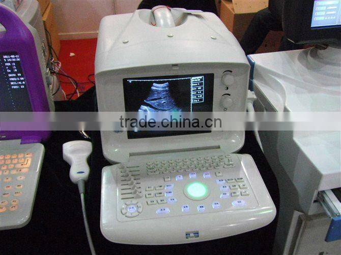 AJ-6100B LCD Portable Pseudo Color US pregnancy scanner ultrasound machine
