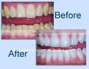 home teeth whitening kit, dental teeth whitening kit, tooth whitening kit, 22%CP syringes,