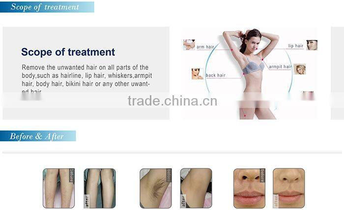 NEW!!!High-performance 600w Germany laser bar aroma hair removal diode laser equipment