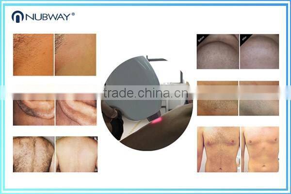 Popular!!! Guarantee 20 million flashes diode laser hair removal 808nm ce approved