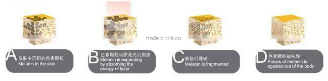 SQ-3 Q Best selling products portable nd yag remove tattoo laser/ erbium yag laser/ erbium yag