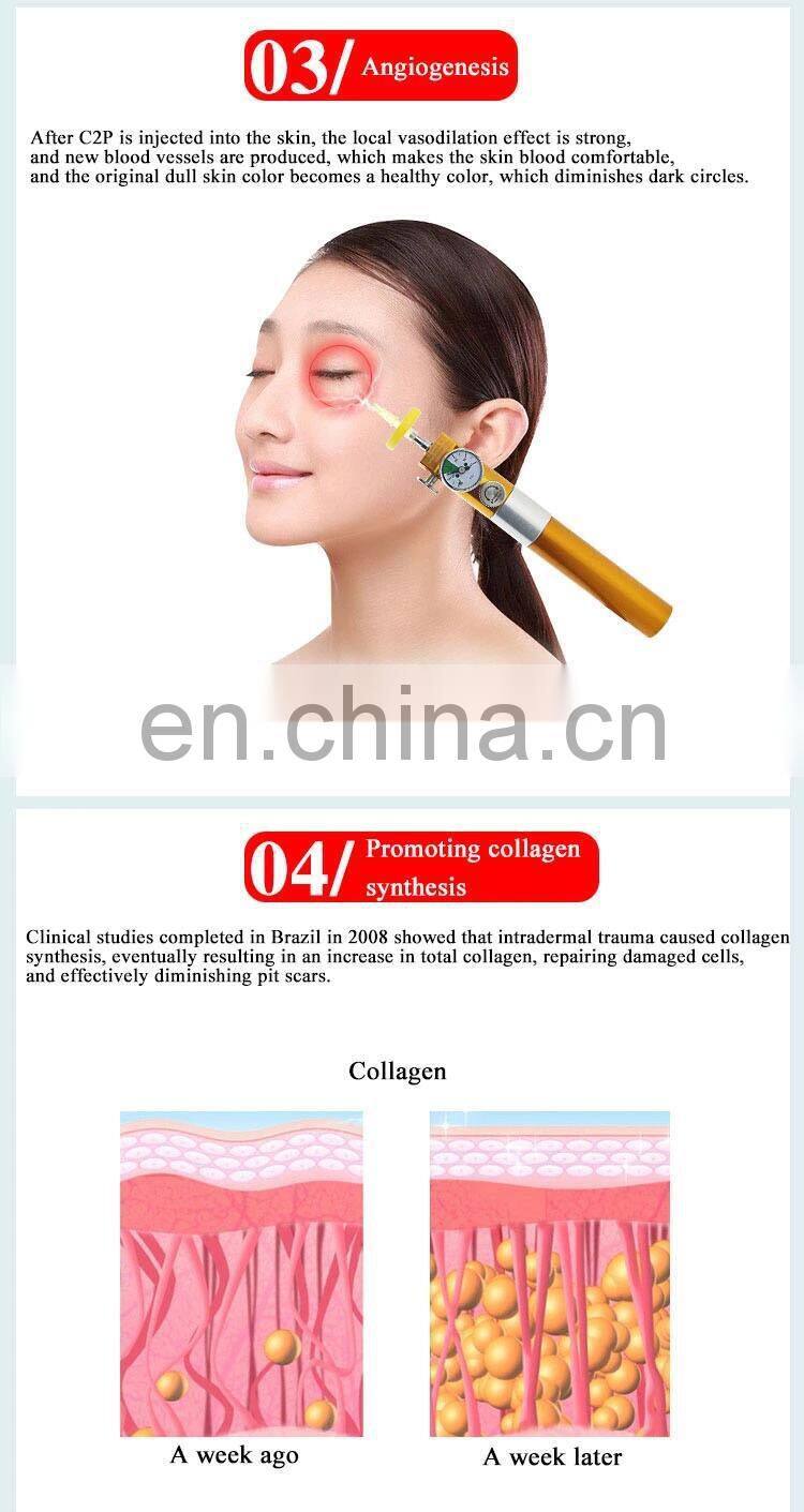 Hot Sale CDT carboxytherapy machine/carboxytherapy/carboxy therapy equipment