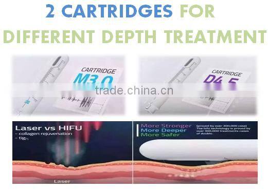 2016 hot selling ultrasonic Hifu vaginal tightening machine