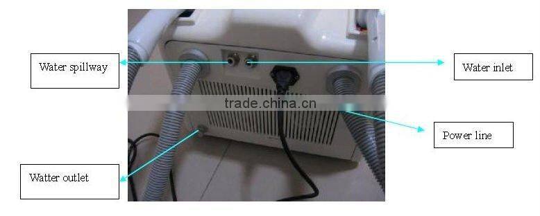Renew The Elasticity Of Skin Photofacial IPL Equipment---A005