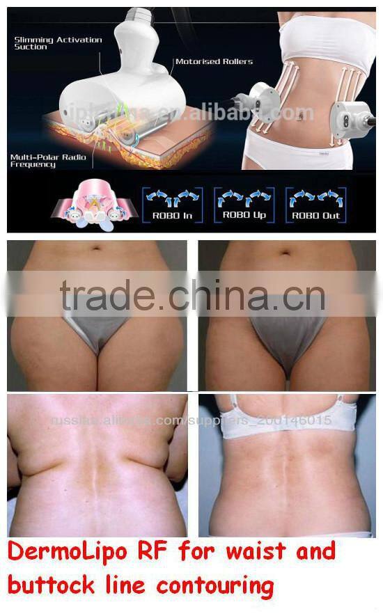 RF Factory sell on Alibaba Home Use beauty FSWT machine Wholesaler