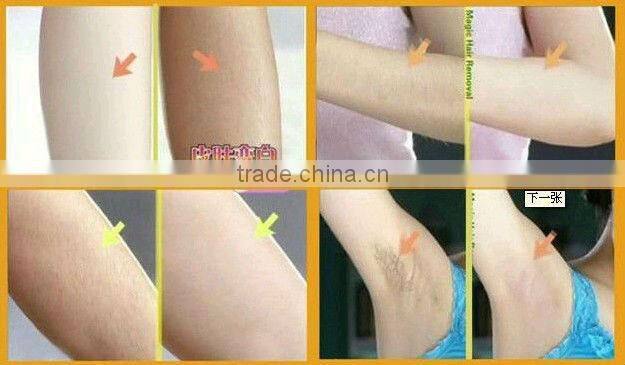 2013 New design ipl hair removal Machine Guangzhou